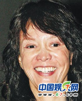 整容女星之凹凸臉